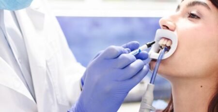 tratament albire dinți la cabinetul stomatologic