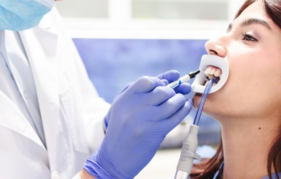 tratament albire dinți la cabinetul stomatologic